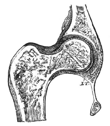 File:Kugelgelenk.jpg