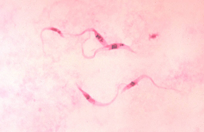 File:Trypanosoma cruzi crithidia.jpeg