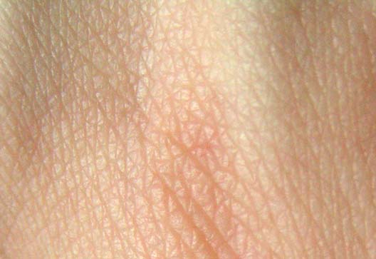 Archivo:Human skin structure.jpg