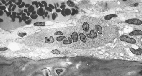 File:Osteoclast.jpg