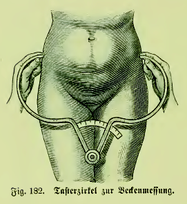 Файл:Die Frau als Hausärztin (1911) 182 Tasterzirkel zur Beckenmessung.png