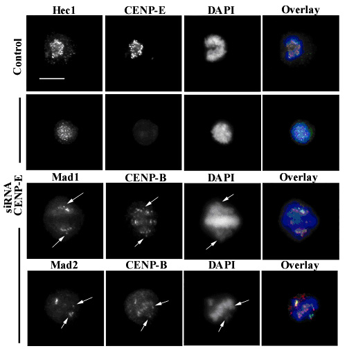 File:SiCENP-E metaphase.png