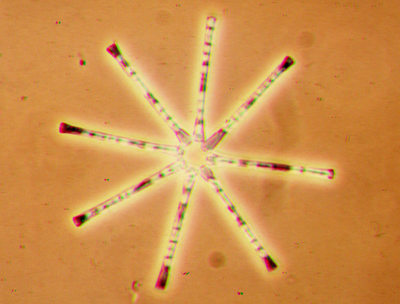 File:Asterionella formosa.jpg