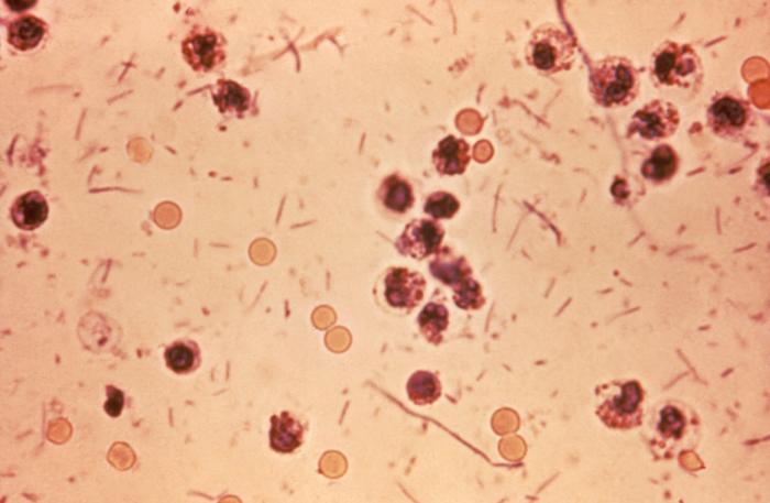 File:Shigella stool.jpg