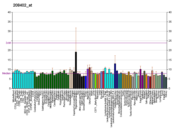 File:PBB GE IL17A 208402 at fs.png