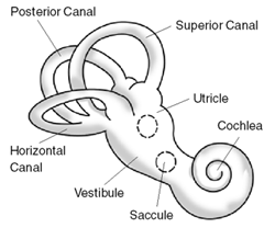 File:Balance Disorder Illustration A.png