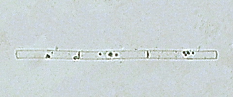 Файл:Leptocylindrus danicus.jpg