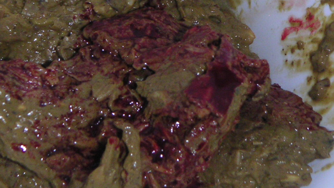 File:Red feces.png