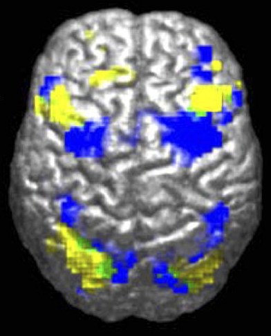 Файл:Powell2004Fig1A.jpeg