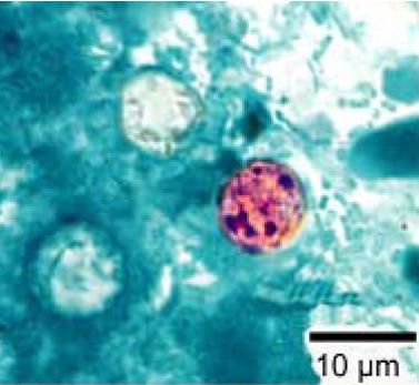 File:Cyclospora cayetanensis stained.jpg