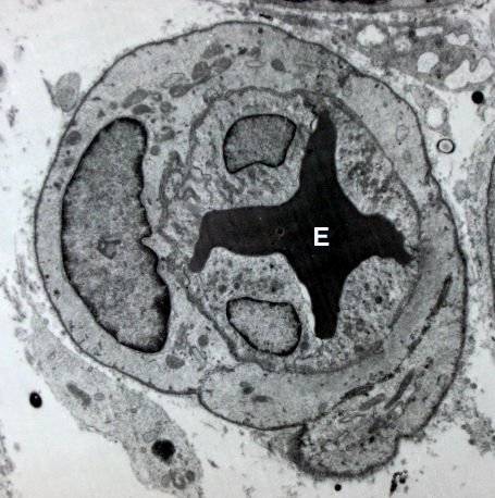 File:Microvessel.jpg