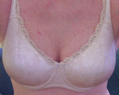 File:CleavageEnhancementStep3BeforeMakeup.JPG