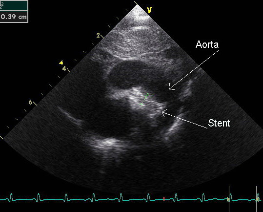 File:Stent tekst.jpg