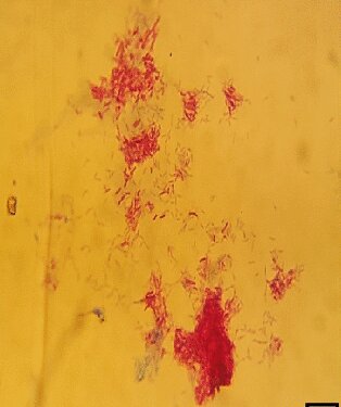 File:Mycobacterium arupense.jpg