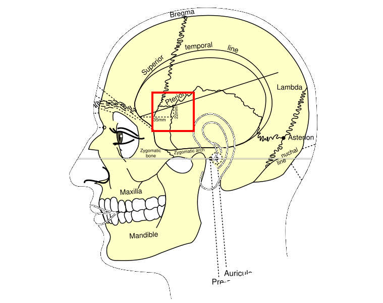 Файл:Pterion.PNG