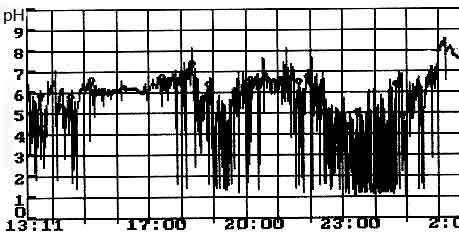 Файл:PH-gramm with GERD.jpg