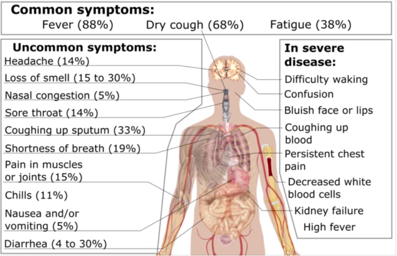 File:SymptomsofCOVID19.jpg