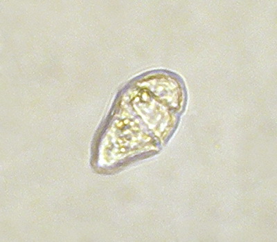 Файл:Cochlodinium pyrum.jpg