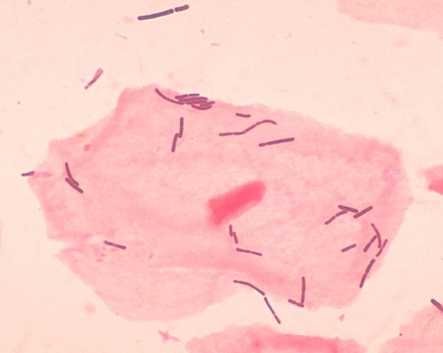 Файл:Lactobacillus sp 01.png