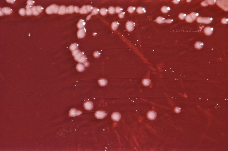 Файл:Pseudomonas aeruginosa 01.jpg