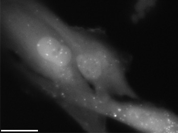 File:Autophagosomes.jpg