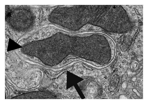 Archivo:Autophagy in plants.jpg