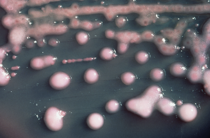 File:Klebsiella pneumoniae 01.png