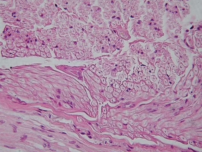 Файл:Peripheral nerve, cross section.jpg