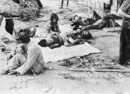 File:Injured Civilians on the street of Nagasaki.jpg