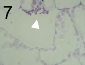 Initiation (arrow head) of a pycnidium of Zymoseptoria tritici in the substomatal cavity of a wheat leaf.