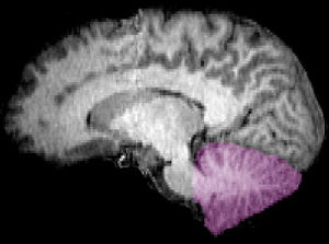 File:Cerebellum sag.jpg