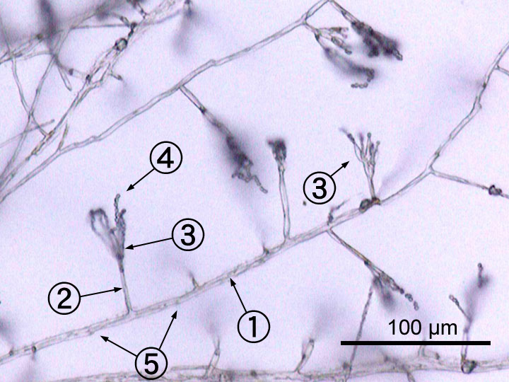 File:Penicillium labeled.jpg