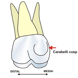 File:Carabelli.jpg