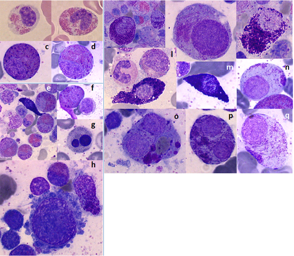 File:Mast Cell Sarcoma.jpg