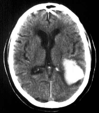 File:Mri041a2.jpg