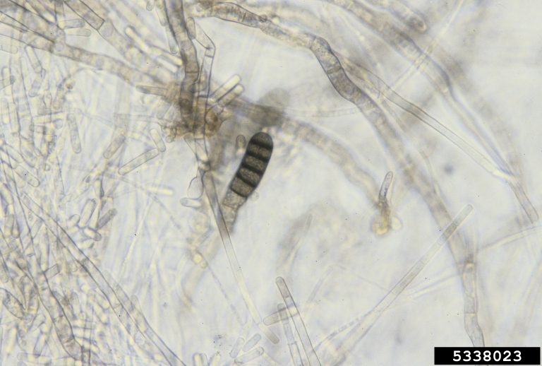 Файл:Thielaviopsis basicola 1.JPG