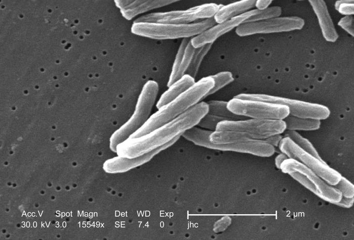 Archivo:Mycobacterium tuberculosis 8438 lores.jpg