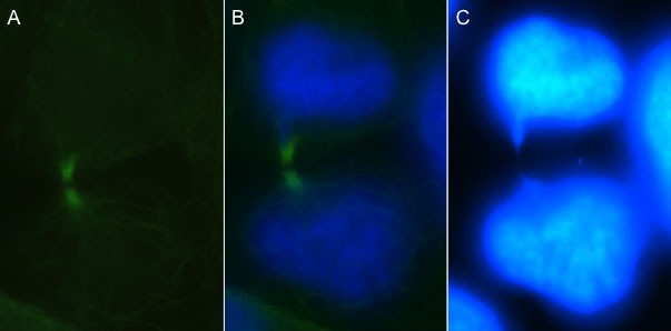 File:DAPI and tubulin staining.jpg