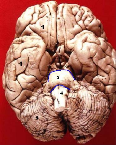 Файл:Human brain inferior view description.JPG