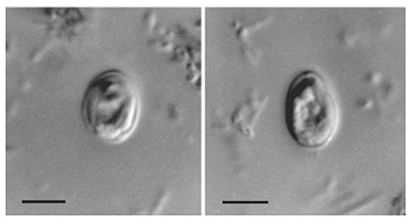 Файл:Cryptosporidium muris.jpg