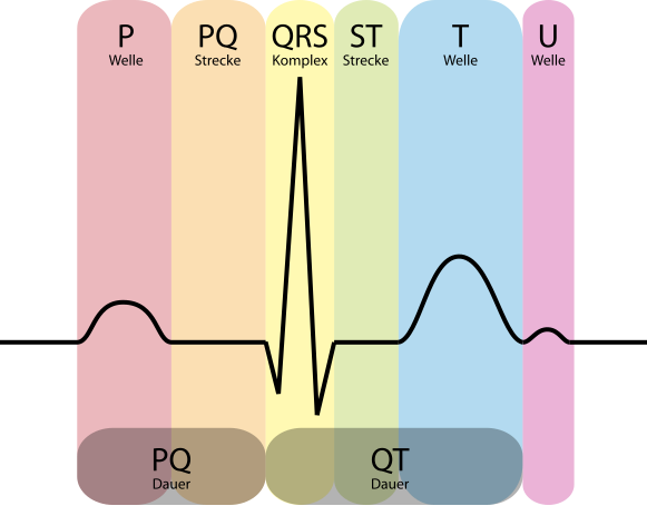 Файл:EKG Komplex.svg