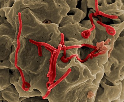 Ebola virus (scanning electron micrograph)