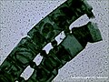 Microscopic view of Spirogyra conjugation