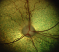 Image 27The dog's retina shows the optic disc and the eye's vasculature. (from Dog anatomy)