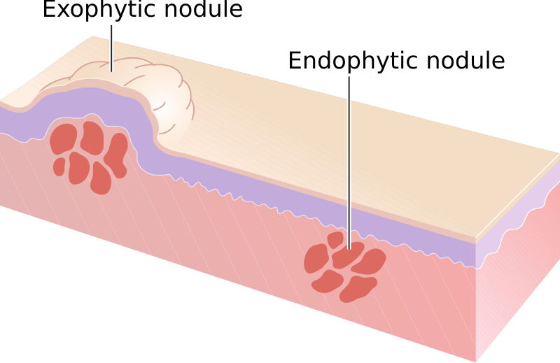 File:Nodules.svg