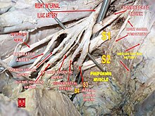 Male hypogastric artery.jpg