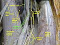 Femoral artery