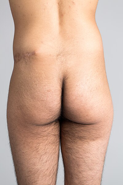 Файл:Buttocks, lower back.jpg