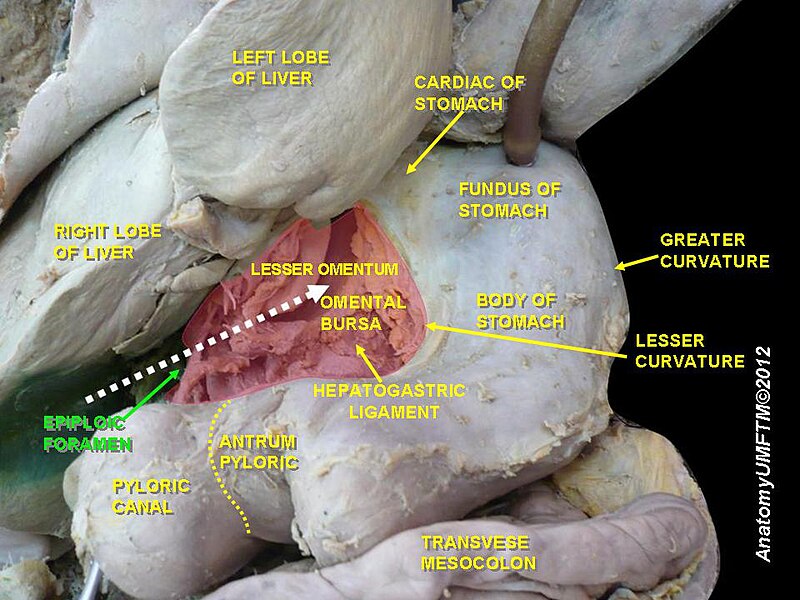 File:Slide5ddd.JPG