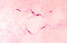 Trypanosoma cruzi